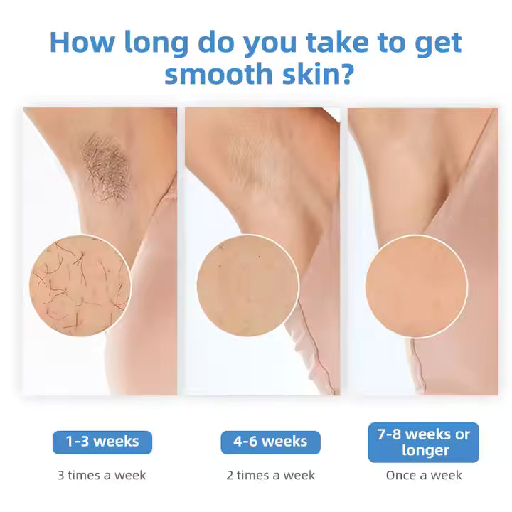 Ice Cooling IPL Permanent Hair Removal Device – Painless Laser Epilator for Face, Legs, Bikini & Full Body